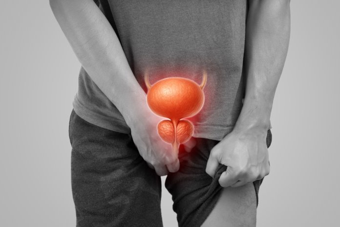 Illustration,Of,Male,Urinary,And,Prostate,Health,Issues.,Useful,For